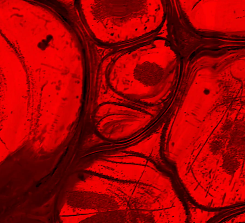 The Link Between PMDD and ADHD